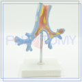 PNT-0751 Modelo Trachea Bronchi para uso médico